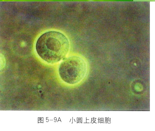 小圆上皮细胞 小圆上皮细胞