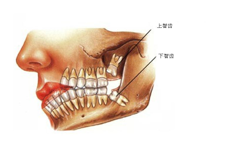 智慧齿 智慧齿
