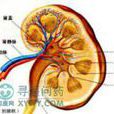 交叉性异位肾