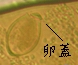 虫卵 虫卵